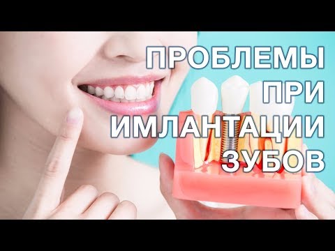 Видео: Какие противопоказания к имплантации зубов?