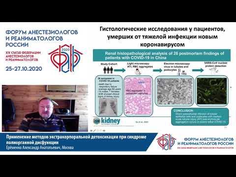 Видео: Экстракорпоральная детоксикация при синдроме ПОН Еременко А.А.