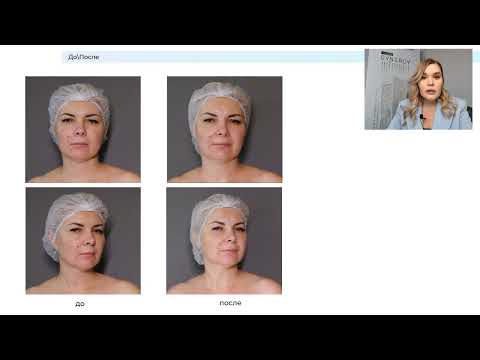 Видео: Обзорный вебинар Skin Synergy от 21.12.2022 | к.б.н. Трифонова Кристина Эдуардовна