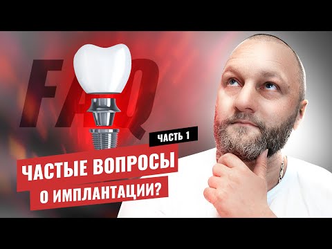 Видео: 🇺🇦 Имплантация зубов – частые вопросы (1-я часть)