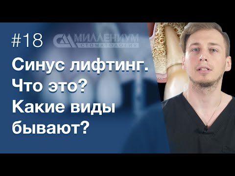 Видео: Страхи по синус-лифтингу.  Открытый или закрытый синус-лифтинг