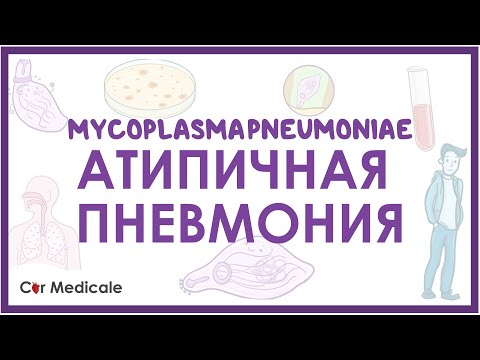 Видео: Атипичная пневмония - Микоплазма пневмонии (M.pneumoniae) - клиника, диагностика, лечение