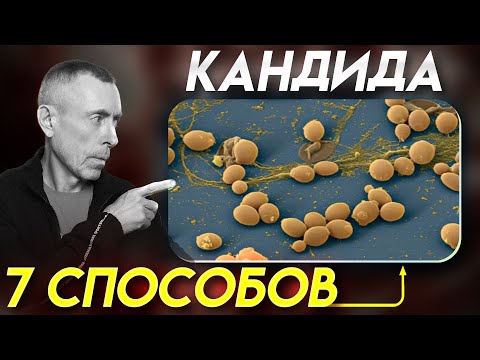 Видео: 7 Способов, Как Избавиться от Кандиды