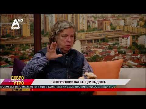 Видео: м-р д-р Митко Караѓозов: Интервенции кај канцер на дојка