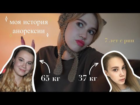 Видео: Моя история анорексии/похудение до 37 кг/7 лет с рпп/вся правда