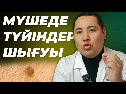 Видео: Мүшеде түйіндер қаптап кетті! Әйелдерге жұғу өте қауіпті! ВПЧ, Папилома, Атерома, Герпес!