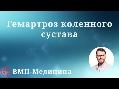 Видео: Гемартроз коленного сустава | ВМП-Медицина