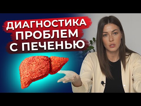 Видео: Как понять, что твоя печень больна? / Признаки болезни печени!