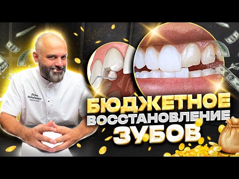 Видео: Как восстановить зубы недорого! Бюджетное Восстановление потерянных зубов. Утратил зуб, что делать?