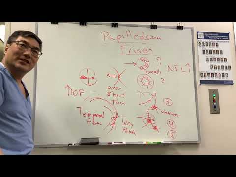 Видео: Оценка отека диска зрительного нерва – шкала Фризена