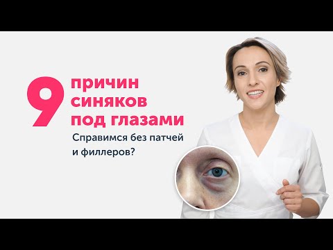 Видео: 9 причин СИНЯКОВ ПОД ГЛАЗАМИ: справимся без патчей и филлеров?