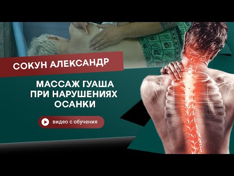 Видео: Массаж Гуаша при нарушениях осанки. Сокун Александр