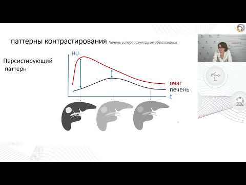 Видео: Контрастирование в КТ   основа визуализации, секреты артериальной фазы