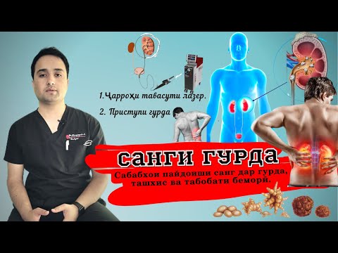 Видео: Бемории санги гурда. Приступи (халладарди) гурда.  Ҷарроҳи санги гурда тавасути лазер.