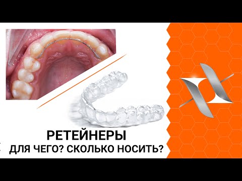 Видео: РЕТЕЙНЕРЫ после БРЕКЕТОВ. (Для чего? Сколько носить? Обязательно?)