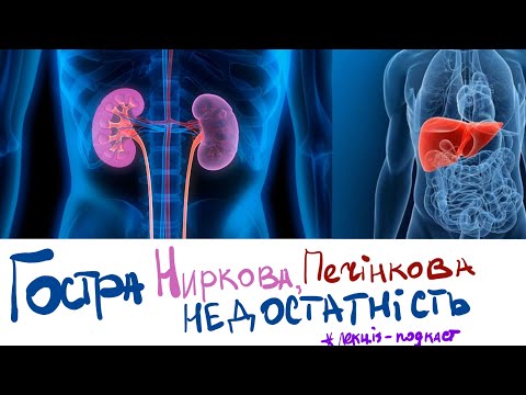 Видео: Гостра ниркова недостатність | Гостра печінкова недостатність : реаніматологія (інтенсивна терапія)