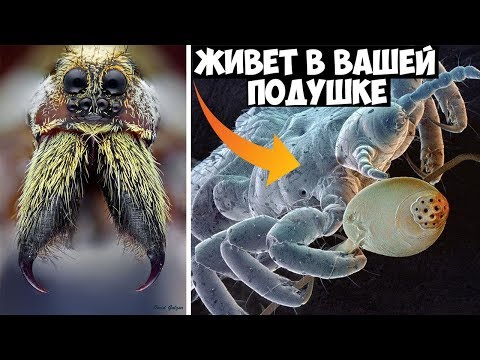 Видео: Фантастические снимки, сделанные электронным микроскопом