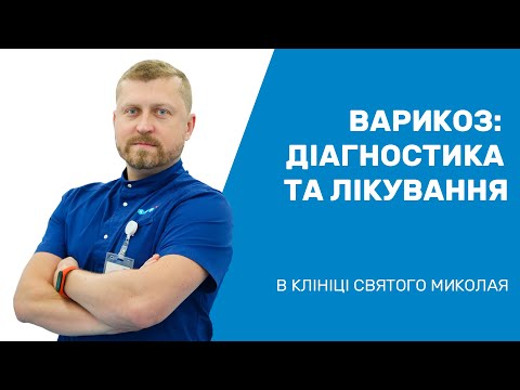 Видео: Варикоз: диагностика и лечение / Варикоз: діагностика та лікування