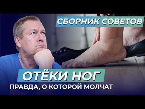 Видео: Как избавиться от отёков ног? Отложение солей в организме: правда, которую скрывают врачи