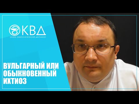 Видео: 1255  Вульгарный или обыкновенный ихтиоз