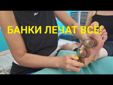 Видео: Банки лечат всё! Огненный массаж стопы. 😳😲 #DIY #massage #health