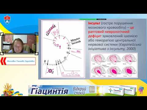 Видео: Московко Геннадій Сергійович "Що ховається за діагнозом дисциркуляторна енцефалопатія?"