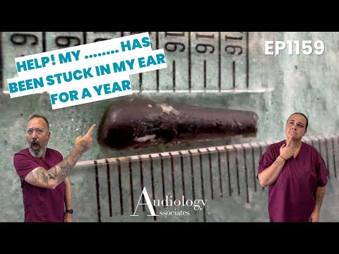 Видео: ПОМОГИТЕ! Мой... застрял у меня в ухе целый год! - EP1159