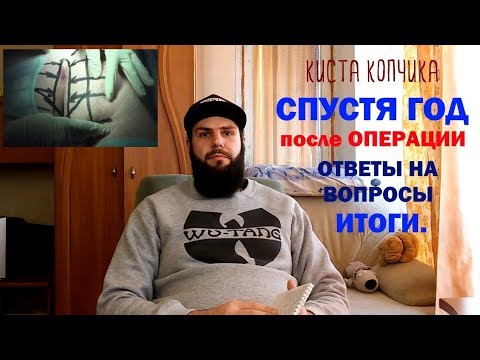 Видео: Спустя год. Киста копчика.Копчиковый ход. / Pilonidal cyst. Surgery. My story Part 2