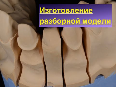 Видео: Изготовление разборной моделе, на пиндекс системе  для начинающего зуботехника