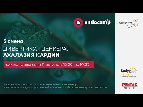 Видео: Дивертикул Ценкера. Ахалазия Кардии (день 2)
