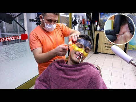 Видео: ASMR Жесткая Чистка Лица от Мурата в барбершопе Cambeyli