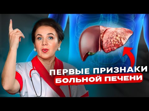 Видео: Очистите печень БЕЗ ТАБЛЕТОК! Как улучшить отток желчи и спасти желчный пузырь?
