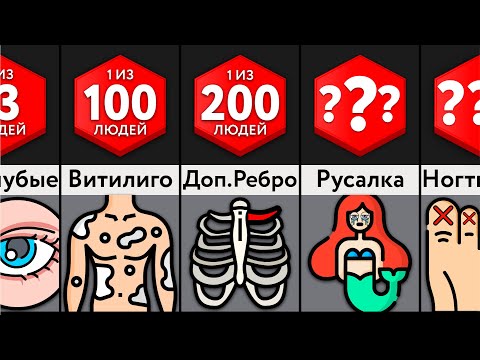 Видео: Редчайшие Генетические Мутации