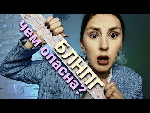 Видео: Блокада левой ножки пучка Гиса. Чем опасна? Что делать?
