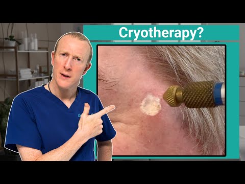 Видео: Почему криотерапия должна стать инструментом номер один для вашего лечащего врача или дерматолога...