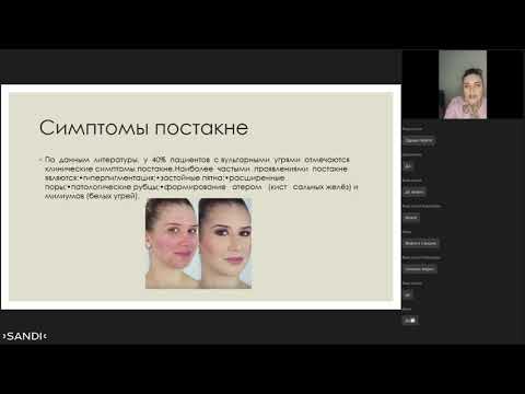 Видео: Проблема постакне и его коррекция.
