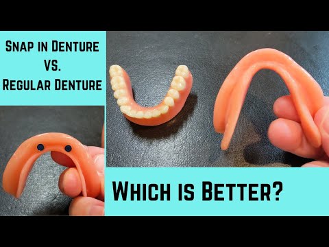 Видео: Почему нижний съемный протез лучше, чем нижний обычный протез