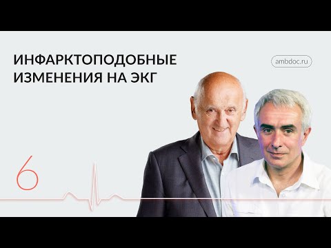 Видео: ЭКГ и «Диагноз в двери». Часть IV. 10.04.24