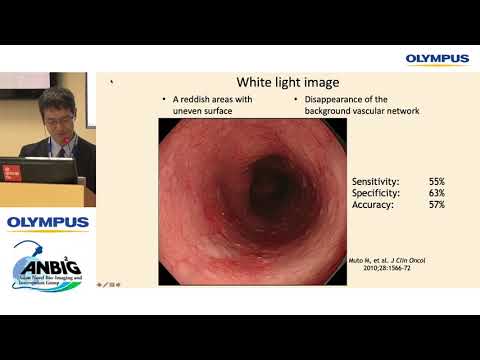 Видео: NBI диагностика и классификация раннего рака пищевода. Н. Уедо