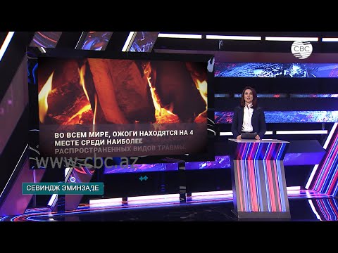 Видео: Что делать при ожоге? Методы лечения ожогов.Ожоговый шок и правило девяток