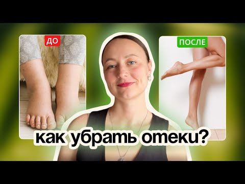Видео: Отеки: что убрать и добавить в жизни, чтобы наконец почувствовать результат.
