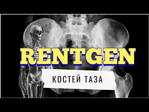 Видео: Рентген таза: учимся читать рентген костей таза📖🙈