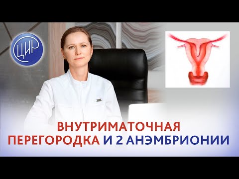 Видео: Внутриматочная перегородка и 2 анэмбрионии. Стоит ли пить Жанин? Тимофеева О.В.