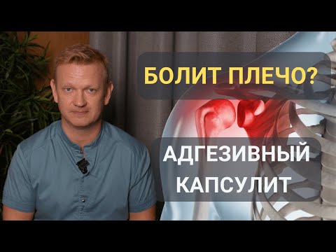Видео: Почему болит плечо? Капсулит. «ЗАМОРОЖЕННОЕ» ПЛЕЧО