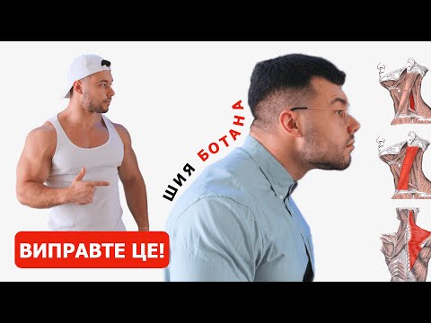 Видео: Як Виправити Нахил Голови Вперед | Сутулу Поставу (Назавжди!)