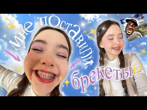 Видео: поставила БреКетЫ✨🫦// сколько стоит? больно?  изменяется ли лицо?!?