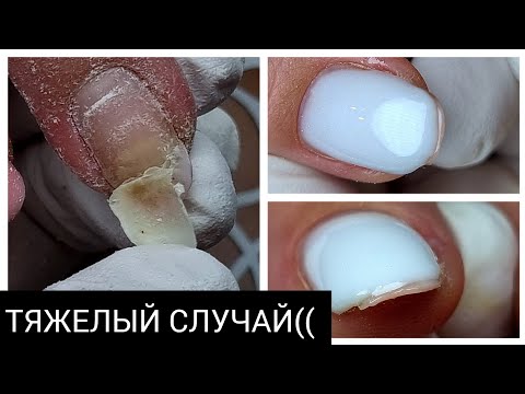 Видео: ПРОБЛЕМНАЯ коррекция