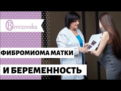 Видео: Фибромиома матки и беременность @Dr. Olena Berezovska