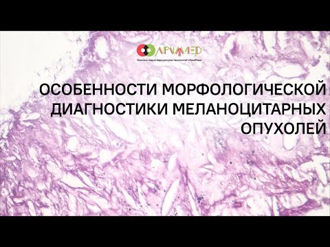 Видео: Особенности морфологической диагностики меланоцитарных опухолей кожи