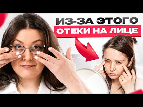 Видео: ОТЕКИ и МЕШКИ под глазами появляются из-за ЭТОГО!